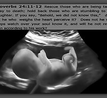 ❀◕‿◕❀LIFE IS A MIRACLE LIFE IS PRECIOUS (BIBLICAL PRO LIFE) CARD/PICTURE❀◕‿◕❀ by ✿✿ Bonita ✿✿ ђєℓℓσ