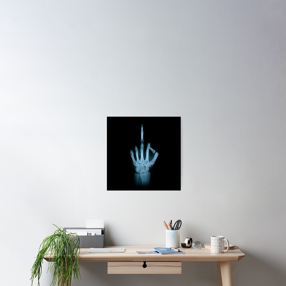 Funny X Ray Middle Finger Anatomy F You Poster For Sale By