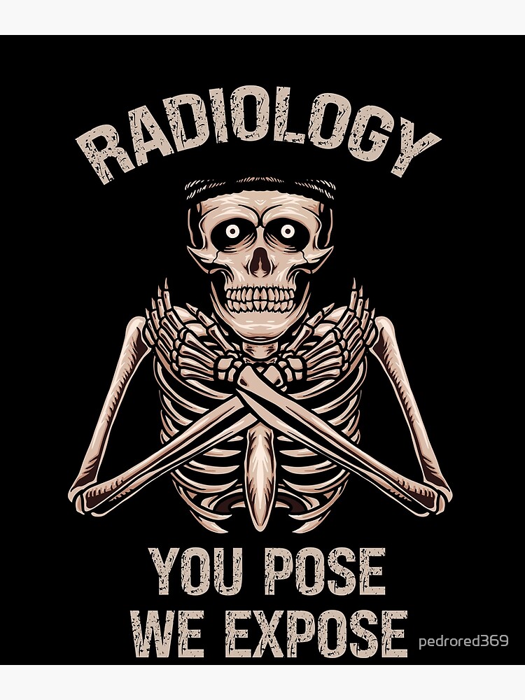 Radiology You Pose We Expose Funny Skeleton Radiologist Design For