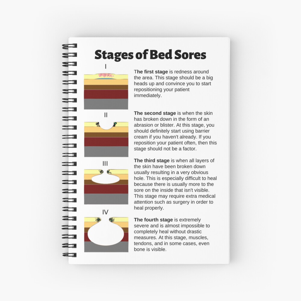 Stages Of Bed Sores Chart Spiral Notebook For Sale By Caregiverology