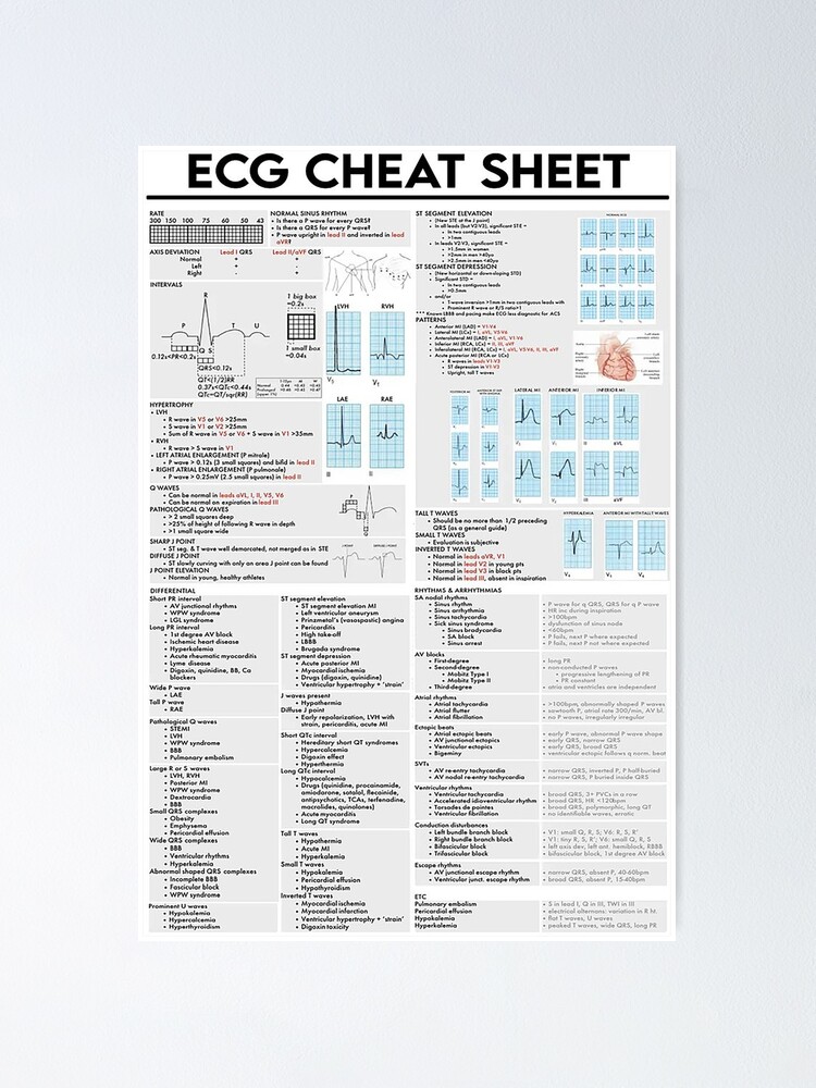 Ecg Cheat Sheet Cardiologist Poster For Sale By Alisonabbottau