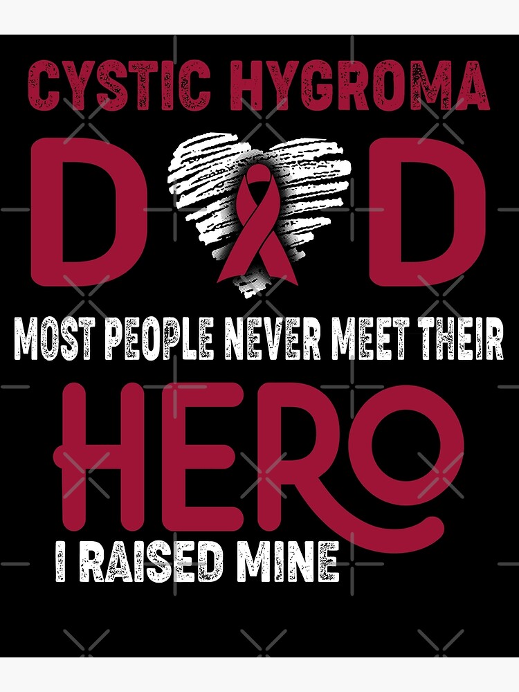 Cystic Hygroma Dad Most People Never Meet Their Hero I Raised Mine