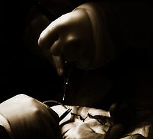 Hand Surgery by damokeen