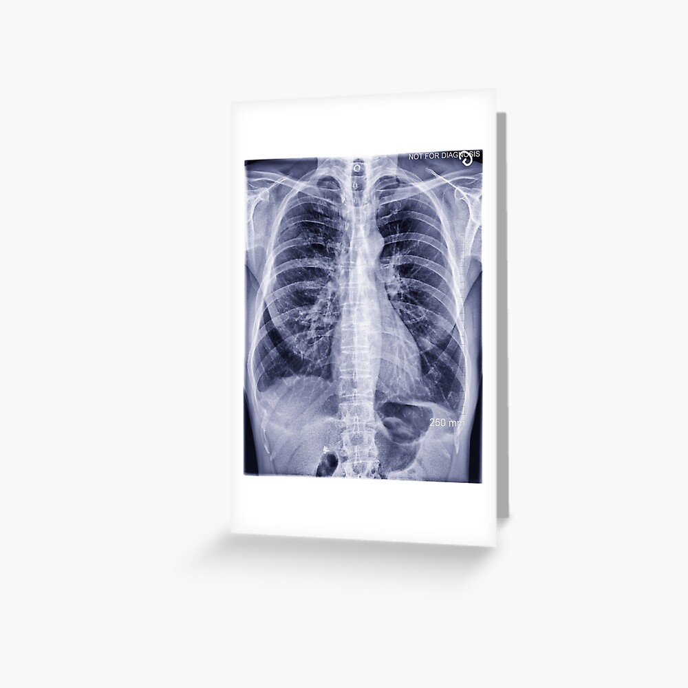 XRAY ONE Greeting Card By LeNumerimagiste Redbubble