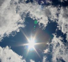 Sun Surround by starlitewonder