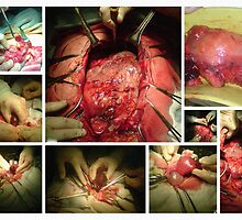 SURGERY by NINA -L