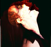 Cerebral Palsy by Adam Brunckhorst