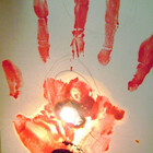 neonpox