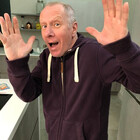 BaldMartinFan1