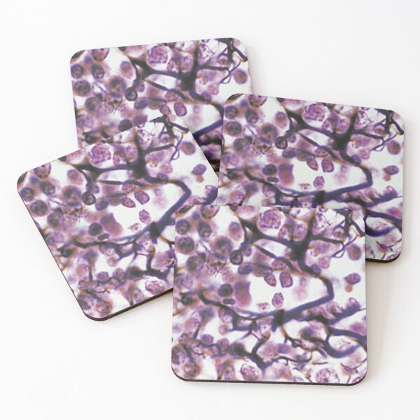 Item preview, Loose Connective Tissue Art designed and sold by darkrose23.