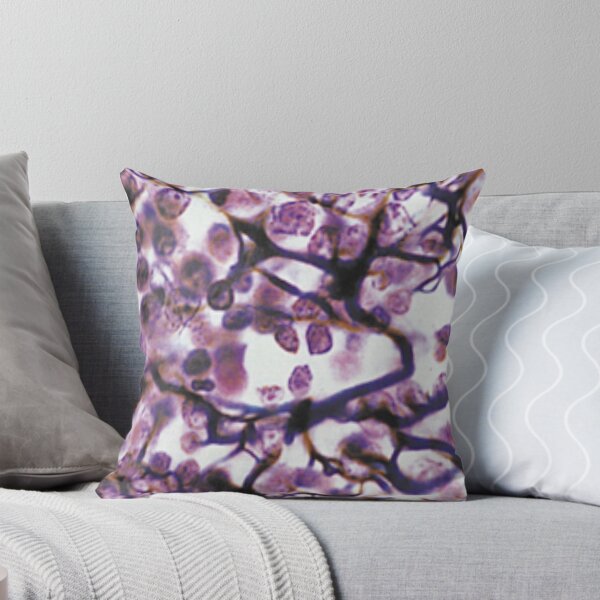 Item preview, Loose Connective Tissue Art designed and sold by darkrose23.