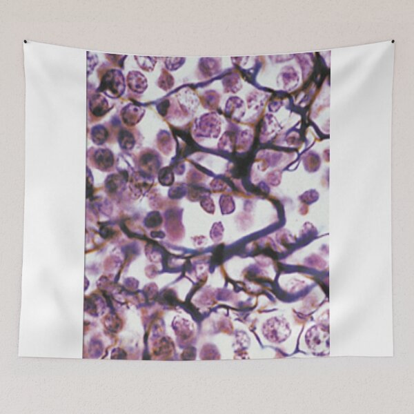Item preview, Loose Connective Tissue Art designed and sold by darkrose23.