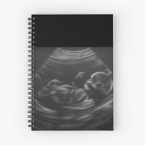Item preview, Unborn designed and sold by Wieslaw Borkowski Jr..