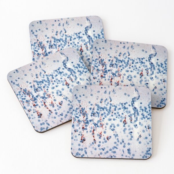 Item preview, Menangle Virus Histology designed and sold by deltoid.