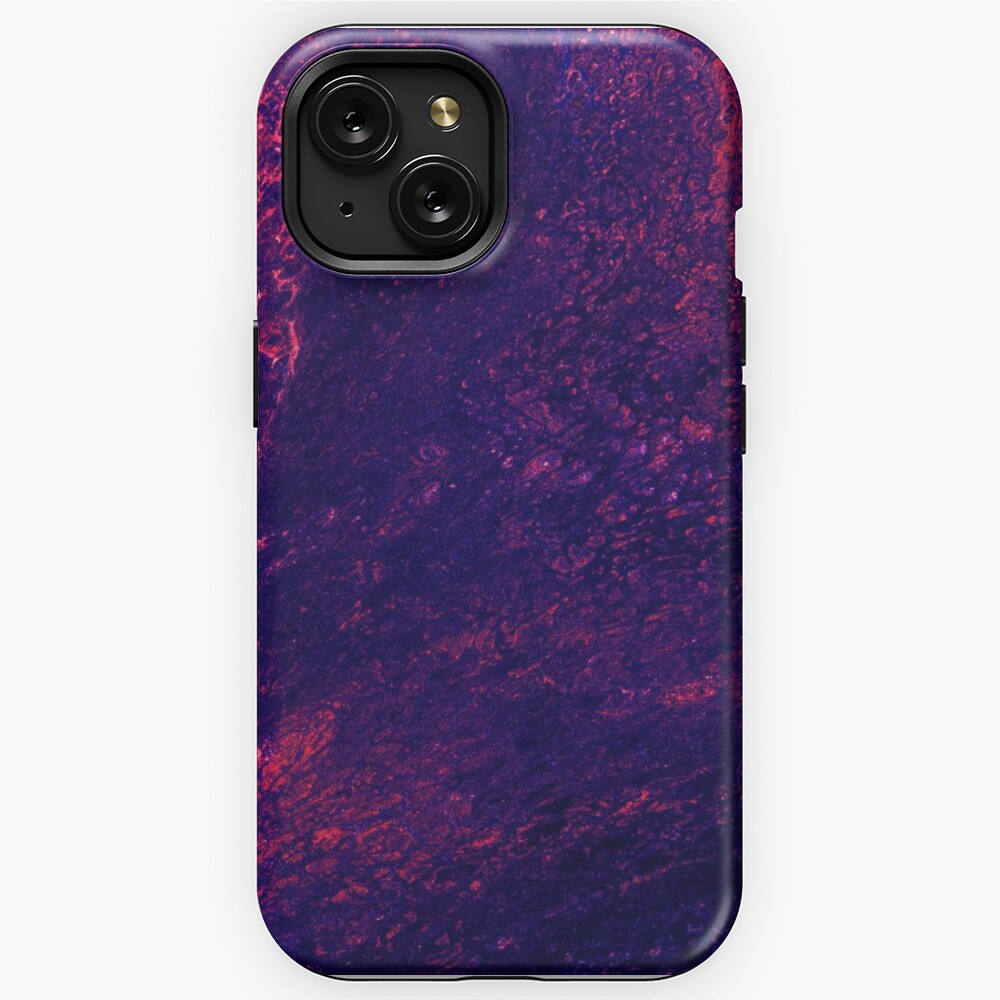 Item preview, iPhone Tough Case designed and sold by InsertTitleHere.