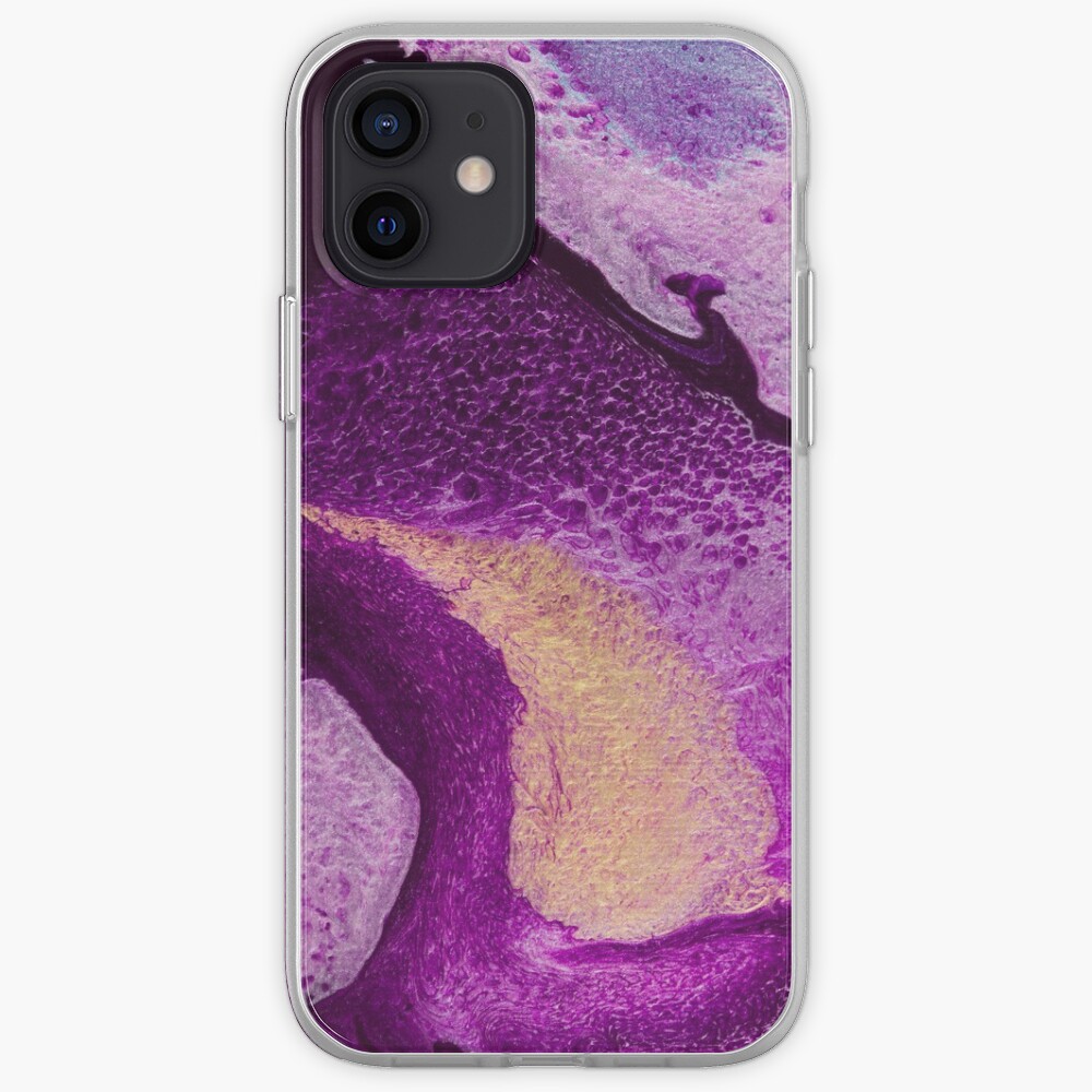 Cellularized iPhone Case & Cover