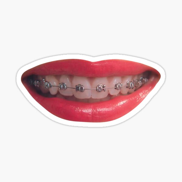 Brace Face Stickers Redbubble - roblox face braces