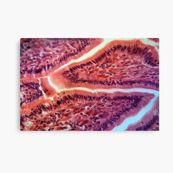 Item preview, Intestine Cells under the Microscope designed and sold by Zosimus.