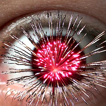 Artwork thumbnail, Exploding Eye by yampy