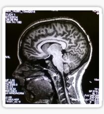 MRI Brain Sticker