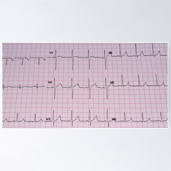 Item preview, Electrocardiogram. designed and sold by FER737NG.