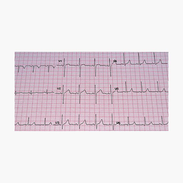 Item preview, Electrocardiogram. designed and sold by FER737NG.