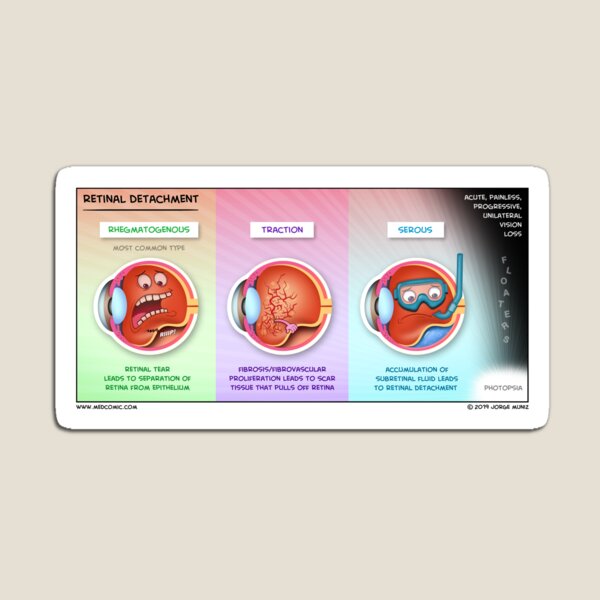 Item preview, Retinal Detachment designed and sold by Medcomic.