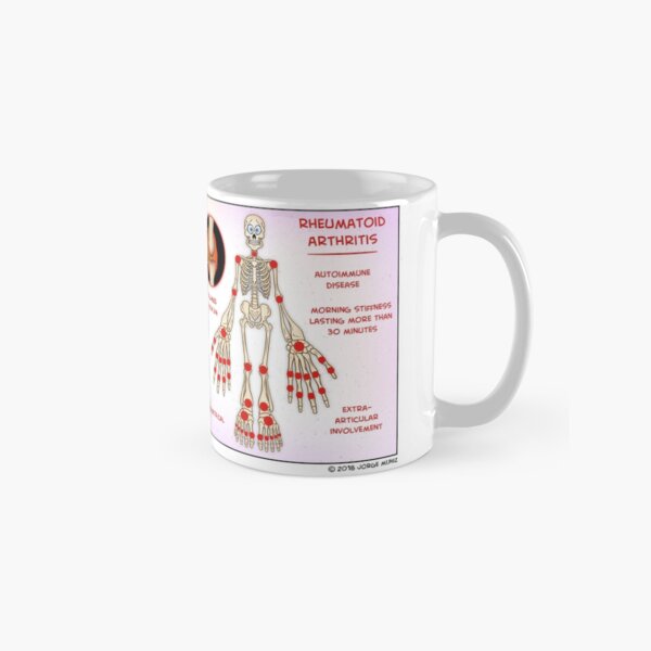 Osteoarthritis vs. Rheumatoid Arthritis Classic Mug
