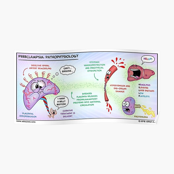 Preeclampsia: Pathophysiology Poster By Medcomic | ubicaciondepersonas ...