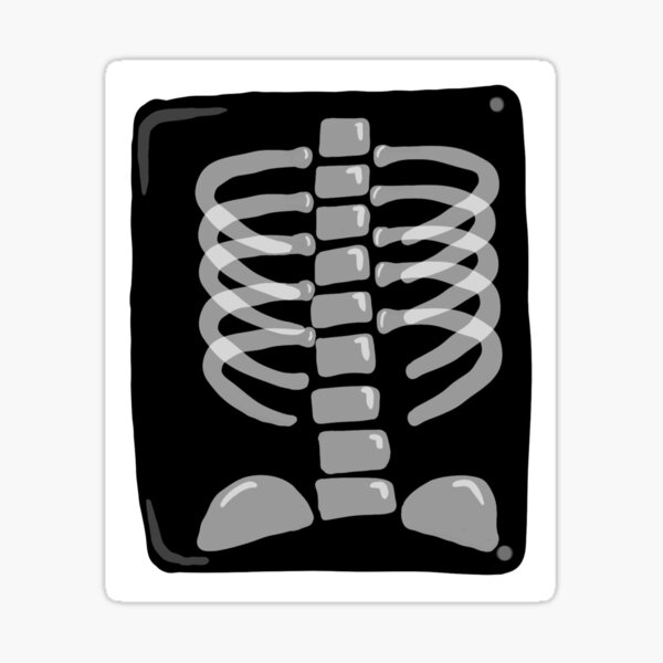 Chest X Ray Stickers for Sale