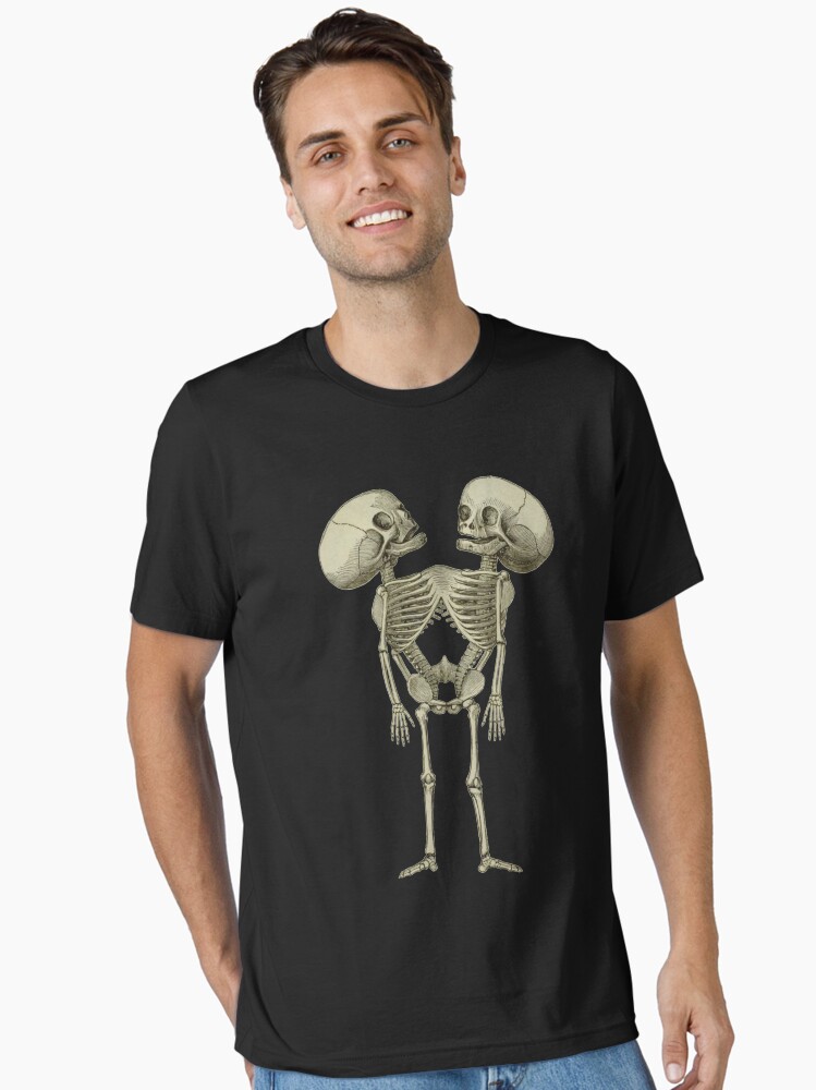 ★SURGERY★ SIAMESE TWIN TYPE-3 T-SHIRTS ☆SURGERY☆ SIAMESE TWIN TYPE-3 T-SHIRTS Siamese Twins Skeleton