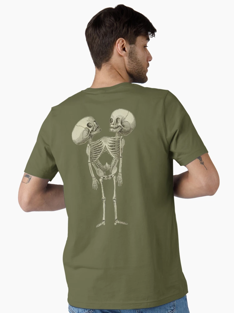 Siamese Twins Skeleton