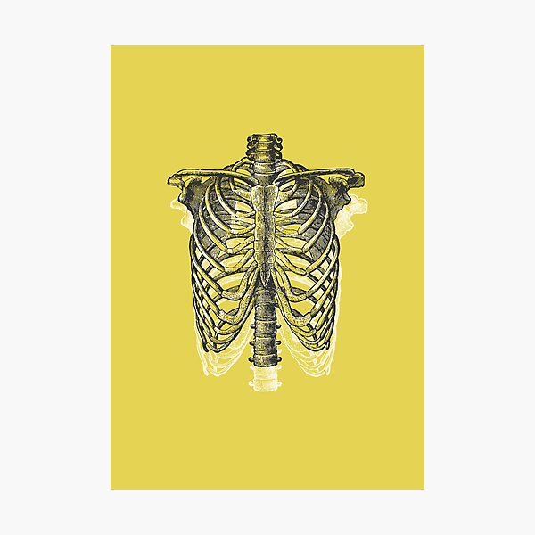Anatomical Ribcage • Yellow • Pastel Goth Photographic Print