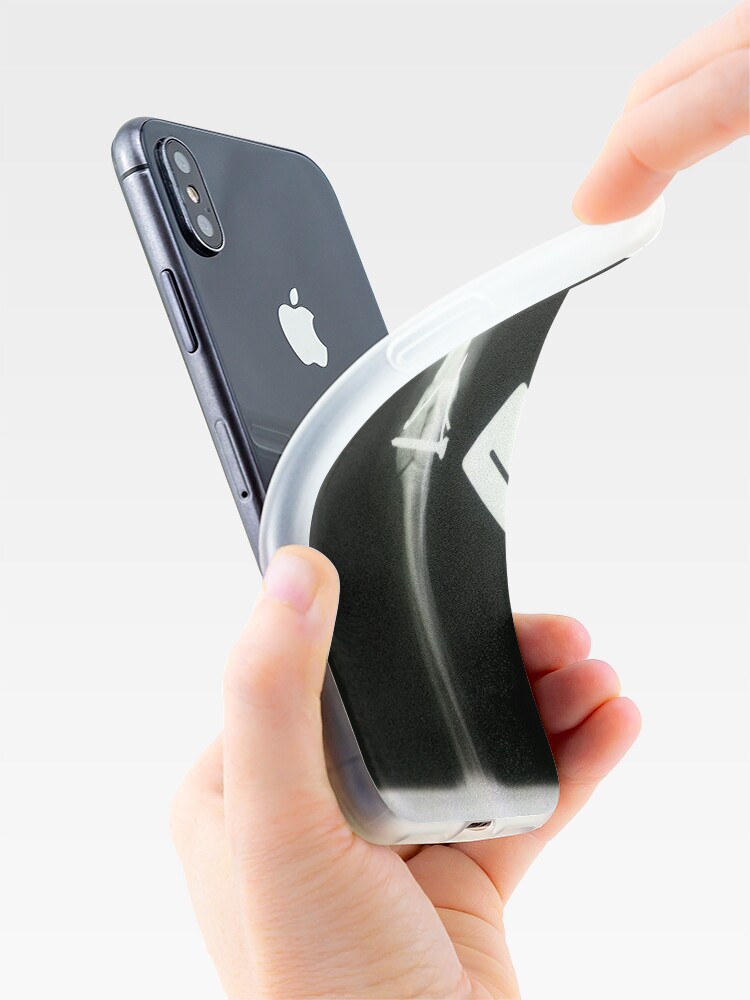 "xray Iphone" iPhone Case for Sale by AmandaCole Redbubble