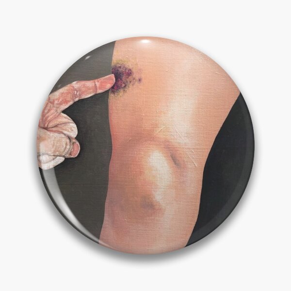 Item preview, Like Poling A Bruise designed and sold by chadberoth.