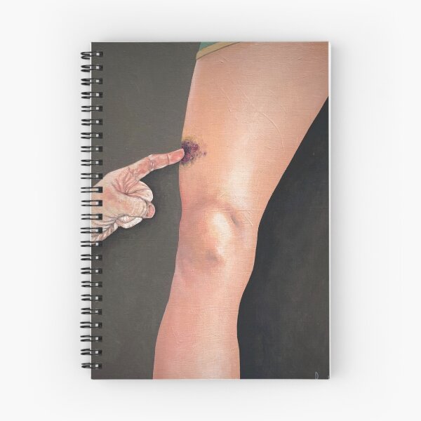 Item preview, Like Poling A Bruise designed and sold by chadberoth.