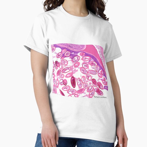 Whipworm Classic T-Shirt