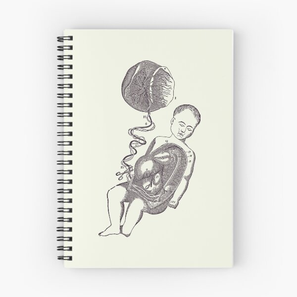Item preview, Baby and Placenta - Placenta Removal - Vintage Anatomy 2 designed and sold by VAposters.