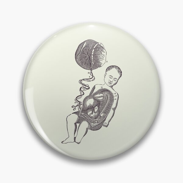 Item preview, Baby and Placenta - Placenta Removal - Vintage Anatomy 2 designed and sold by VAposters.