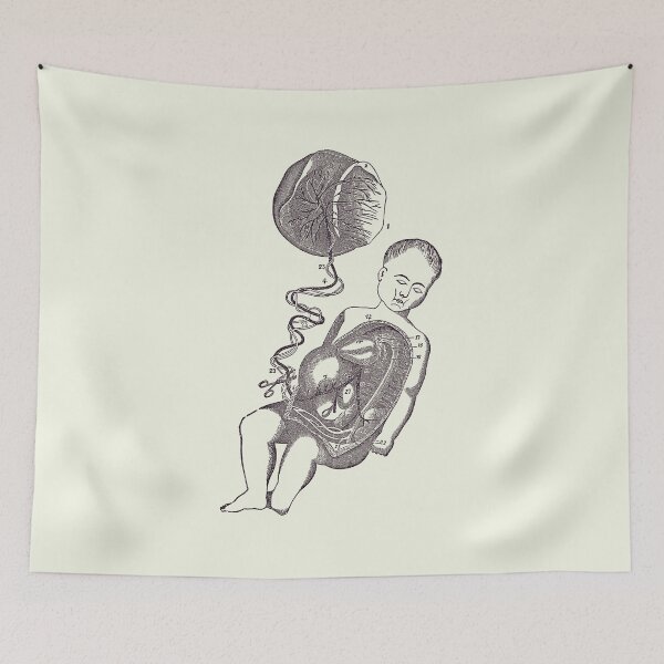 Item preview, Baby and Placenta - Placenta Removal - Vintage Anatomy 2 designed and sold by VAposters.