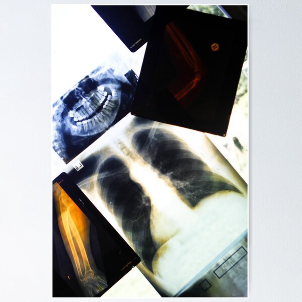 X-Rays Poster