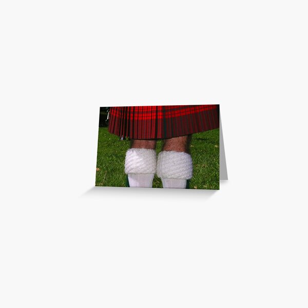 Hairy legs Greeting Card