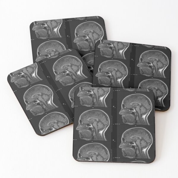 Item preview, Headcase Monochrome Brain Scan Repeat designed and sold by grinningskull.