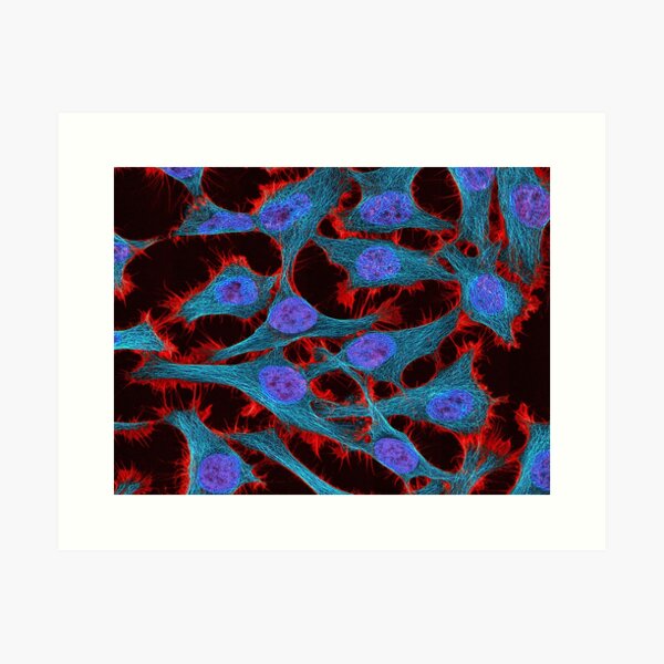 HeLa cells from Henrietta Lacks Art Print