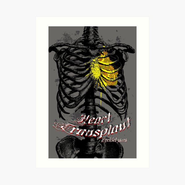 Heart Transplant Art Print