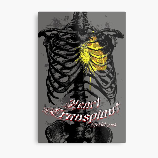 Heart Transplant Metal Print