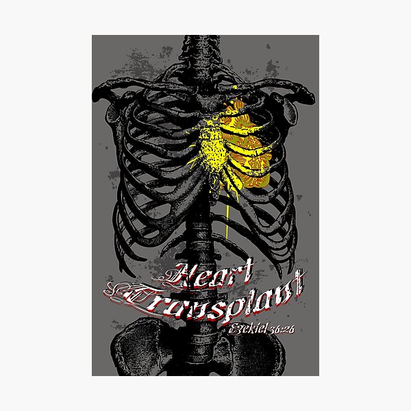 Heart Transplant Photographic Print
