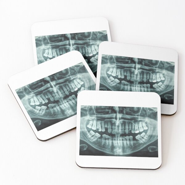 Item preview, X ray teeth scan designed and sold by Delicarte.