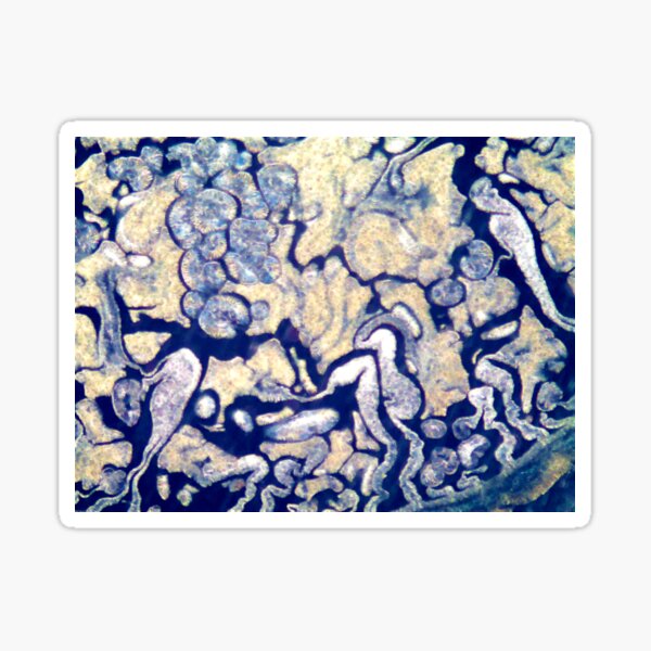 Sea Anemone Sticker