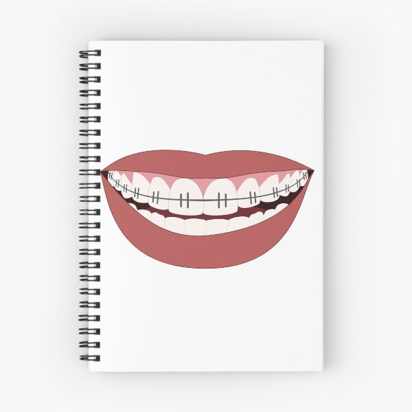 Item preview, Cute Braces Smile designed and sold by Ndigwan.